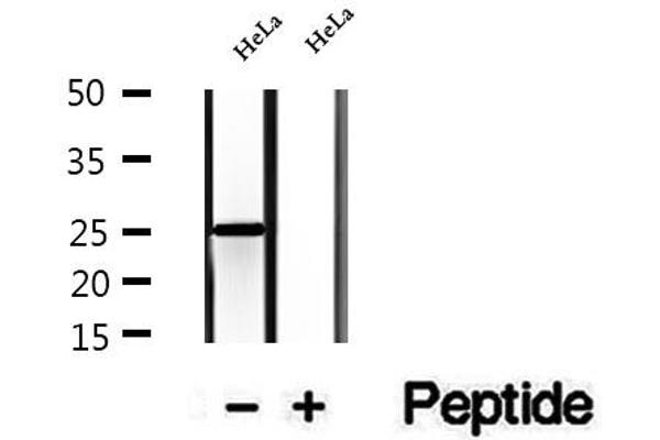 CHCHD6 antibody  (Internal Region)