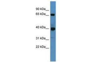 Image no. 1 for anti-UDP-N-Acetyl-alpha-D-Galactosamine:polypeptide N-Acetylgalactosaminyltransferase 11 (GalNAc-T11) (GALNT11) (AA 98-147) antibody (ABIN6746309) (GALNT11 antibody  (AA 98-147))