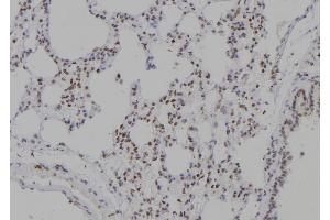 ABIN6277236 at 1/100 staining Rat lung tissue by IHC-P. (TCOF1 antibody  (N-Term))