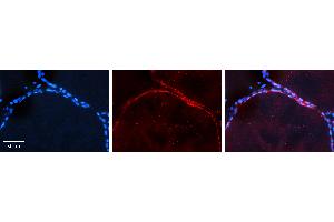 Rabbit Anti-AKT2 Antibody   Formalin Fixed Paraffin Embedded Tissue: Human Thyroid Tissue Observed Staining: Plasma membrane in follicular cells Primary Antibody Concentration: 1:100 Other Working Concentrations: 1:600 Secondary Antibody: Donkey anti-Rabbit-Cy3 Secondary Antibody Concentration: 1:200 Magnification: 20X Exposure Time: 0. (AKT2 antibody  (Middle Region))