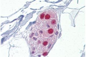 Anti-NR3C1 / Glucocorticoid Receptor antibody IHC staining of human colon, submucosal plexus. (Glucocorticoid Receptor antibody  (AA 180-229))