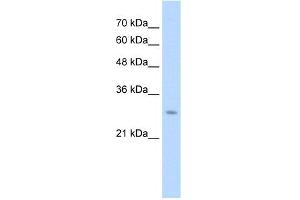 WB Suggested Anti-UBE2J2 Antibody Titration:  1. (UBE2J2 antibody  (C-Term))