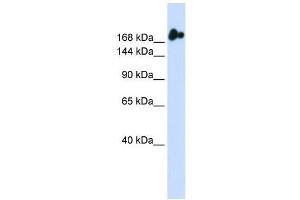 NUP98 antibody used at 0. (NUP98 antibody  (N-Term))