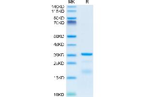 Hepsin Protein (HPN) (AA 60-436) (His tag)