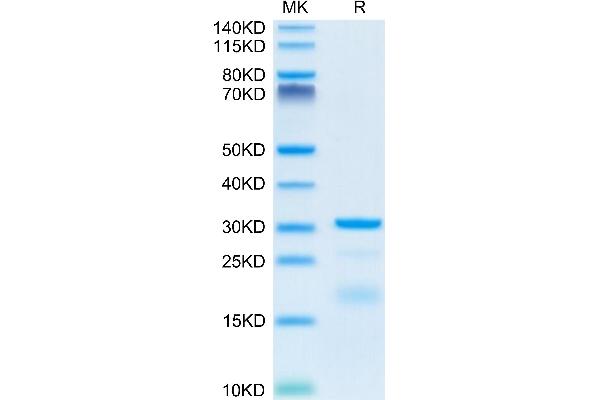 Hepsin Protein (HPN) (AA 60-436) (His tag)