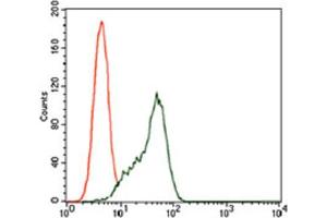 Immunohistochemical analysis of paraffin-embedded rectum cancer tissues using STAT5A antibody with DAB staining. (STAT5A antibody  (AA 583-794))
