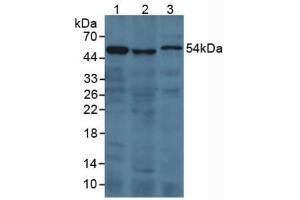 Figure. (Prothrombin Fragment 1+2 antibody  (AA 44-327))