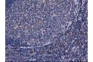 Image no. 1 for anti-Catalase (CAT) antibody (ABIN1497109) (Catalase antibody)