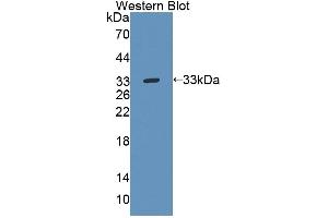 Detection of Recombinant TEC, Human using Polyclonal Antibody to Tec Protein Tyrosine Kinase (TEC)