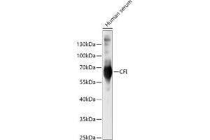 Western blot analysis of extracts of Human serum, using CFI antibody (ABIN6127713, ABIN6138461, ABIN6138462 and ABIN6221257) at 1:500 dilution.
