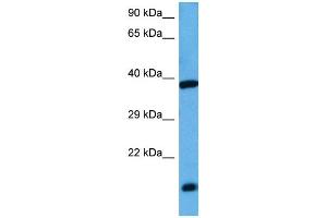 Host:  Rabbit  Target Name:  ATF4  Sample Tissue:  Mouse Kidney  Antibody Dilution:  1ug/ml
