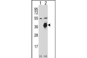 Western blot analysis of PLAUR (arrow) using rabbit polyclonal PLAUR Antibody  (ABIN652429 and ABIN2842227). (PLAUR antibody  (AA 136-166))