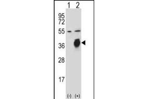 Western blot analysis of PLAUR (arrow) using rabbit polyclonal PLAUR Antibody  (ABIN652429 and ABIN2842227).