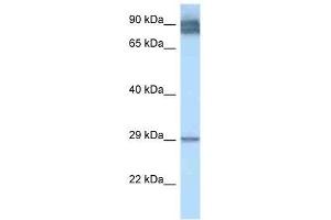 Western Blot showing LRAT antibody used at a concentration of 1. (LRAT antibody  (N-Term))