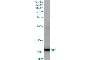 Western Blotting (WB) image for anti-TATA-Binding Protein-Associated Phosphoprotein (DR1) (AA 1-176) antibody (ABIN515068)