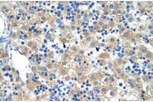 Immunohistochemical staining (Formalin-fixed paraffin-embedded sections) of human liver with FERD3L polyclonal antibody  at 4-8 ug/mL working concentration. (FERD3L antibody  (N-Term))