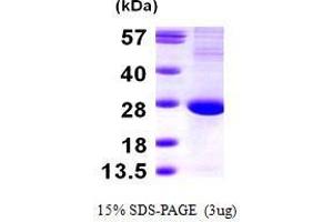 Figure annotation denotes ug of protein loaded and % gel used. (Translin Protein (TSN) (AA 1-228))