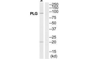 Western blot analysis of extracts from Jurkat cells, using PLG antibody. (PLG antibody  (N-Term))