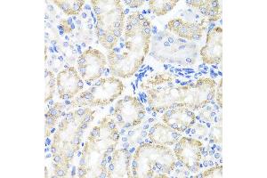 Immunohistochemistry of paraffin-embedded mouse kidney using SPICE1 antibody at dilution of 1:100 (x40 lens). (SPICE1 antibody)
