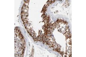 Immunohistochemical staining of human testis with ITPR3 polyclonal antibody  shows cytoplasmic positivity in cells in seminiferus ducts at 1:200-1:500 dilution.