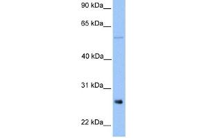 WB Suggested Anti-METTL7B Antibody Titration:  0. (METTL7B antibody  (Middle Region))