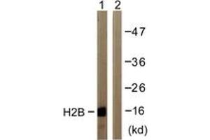 Western blot analysis of extracts from COS7 cells, treated with TSA 400nM 24h, using Histone H2B (Ab-12) Antibody. (Histone H2B antibody  (AA 10-59))