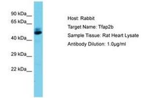 Image no. 1 for anti-Transcription Factor AP-2 beta (Activating Enhancer Binding Protein 2 Beta) (TFAP2B) (AA 104-153) antibody (ABIN6750458) (TFAP2B antibody  (AA 104-153))