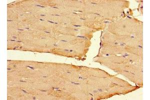 Immunohistochemistry of paraffin-embedded human skeletal muscle tissue using ABIN7167899 at dilution of 1:100 (RIPOR2 antibody  (AA 1-250))