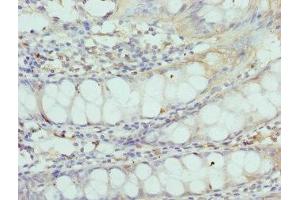 Immunohistochemistry of paraffin-embedded human colon tissue using ABIN7148825 at dilution of 1:100 (CNGA3 antibody  (AA 1-165))