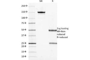 SDS-PAGE (SDS) image for anti-Keratin 18 (KRT18) antibody (ABIN3026960)