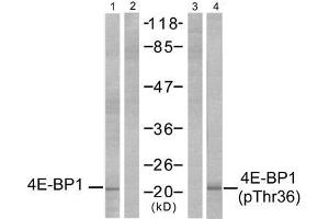 Western blot analysis of extracts from MDA-MB-435 cells, untreated or EGF-treated (200ng/ml, 30min), using 4E-BP1 (Ab-36) antibody (E021215, Lane 1 and 2) and 4E-BP1 (phospho-Thr36) antibody (E011222, Lane 3 and 4). (eIF4EBP1 antibody)