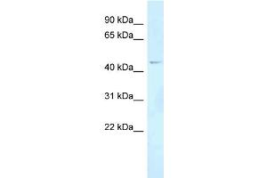 WB Suggested Anti-FOXN2 Antibody Titration: 1. (FOXN2 antibody  (Middle Region))