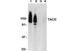 Western blot analysis of TACE in HeLa (1,3) and Jurkat (2,4) whole cell lysate in the absence (1,2) or presence (3,4) of blocking peptide with TACE Antibody  at 1 μg/ml. (ADAM17 antibody  (C-Term))