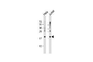 All lanes : Anti-RPS11 Antibody (Center) at 1:1000 dilution Lane 1: Hela whole cell lysate Lane 2: Jurkat whole cell lysate Lysates/proteins at 20 μg per lane.