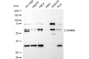 anti-Calcium/calmodulin-Dependent Protein Kinase IV (CAMK4) antibody