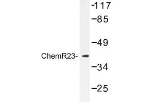 Image no. 1 for anti-Chemokine-Like Receptor 1 (CMKLR1) antibody (ABIN272278) (CMKLR1 antibody)