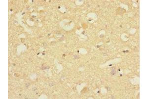 Immunohistochemistry of paraffin-embedded human brain tissue using ABIN7148481 at dilution of 1:100 (CNTNAP1 antibody  (AA 20-300))
