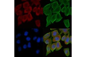ABIN6259045 and ABIN6275255 staining Hela cells(30 min of UV treatment) by IF/ICC.