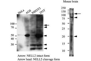 Western Blotting (WB) image for anti-NEL-Like 2 (Chicken) (NELL2) antibody (ABIN614304) (NELL2 antibody)
