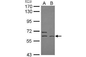 WB Image ELP3 antibody [N3C3] detects ELP3 protein by Western blot analysis. (ELP3/KAT9 antibody  (Center))