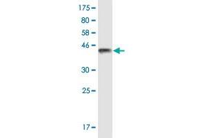 Western Blot detection against Immunogen (37. (TRPV1 antibody  (AA 21-124))
