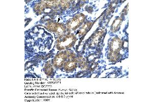 Immunohistochemistry (IHC) image for anti-SP140 Nuclear Body Protein (SP140) (N-Term) antibody (ABIN182690) (SP140 antibody  (N-Term))