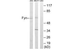 Western blot analysis of extracts from HUVEC cells, MCF-7 cells and 293 cells, using Fyn (Ab-530) antibody. (FYN antibody  (Tyr530))