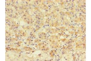 Immunohistochemistry of paraffin-embedded human adrenal gland tissue using ABIN7172677 at dilution of 1:100 (TAF13 antibody  (AA 1-124))