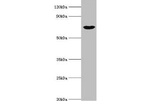 Western blot All lanes: cGMP-dependent protein kinase 1 antibody at 3 μg/mL + Mouse lung tissue Secondary Goat polyclonal to rabbit IgG at 1/10000 dilution Predicted band size: 77, 78, 45 kDa Observed band size: 77 kDa (PRKG1 antibody  (AA 1-300))