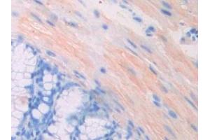 Detection of PGP in Mouse Colon Tissue using Polyclonal Antibody to Phosphoglycolate Phosphatase (PGP) (PGP antibody  (AA 81-321))