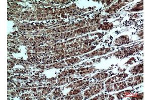 Immunohistochemistry (IHC) analysis of paraffin-embedded Human Stomach, antibody was diluted at 1:100. (PPP1R15B antibody  (Internal Region))