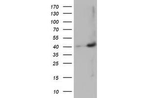 HEK293T cells were transfected with the pCMV6-ENTRY control (Left lane) or pCMV6-ENTRY MAGEB18 (Right lane) cDNA for 48 hrs and lysed. (MAGEB18 antibody)