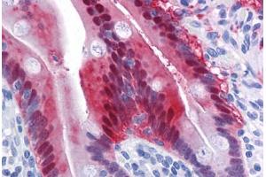 Human Small Intestine: Formalin-Fixed, Paraffin-Embedded (FFPE) (AKR1B10 antibody  (AA 76-144))