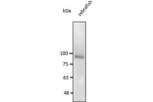 Endogenous CDH11 detected at 1:2,000 dilution, lysate of 3 day embryo at 50 µg per Iane and rabbit polyclonal to goat lgG (HRP) at 1/10,000 dilution. (OB Cadherin antibody)